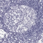 Immunohistochemical staining of human lymph node shows no positivity in germinal center cells as expected.