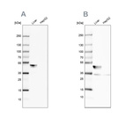 Anti-BHMT Antibody