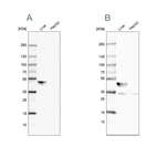 Western blot analysis using Anti-BHMT antibody HPA058310 (A) shows similar pattern to independent antibody HPA038285 (B).