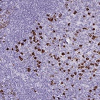 Anti-CDADC1 Antibody