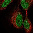 Anti-COL9A3 Antibody