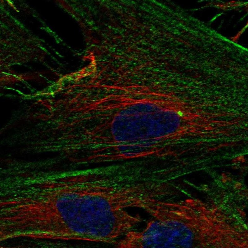 Anti-NPTX2 Antibody