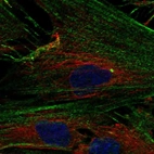Anti-NPTX2 Antibody