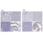 Immunohistochemical staining of human kidney, liver, pancreas and testis using Anti-STAG3 antibody HPA058330 (A) shows similar protein distribution across tissues to independent antibody HPA049106 (B).