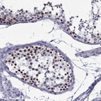 Immunohistochemical staining of human testis shows strong nuclear positivity in cells in seminiferous ducts.