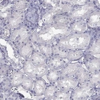 Immunohistochemical staining of human kidney shows no positivity in cells in tubules as expected.