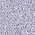 Immunohistochemical staining of human liver shows no positivity in hepatocytes as expected.
