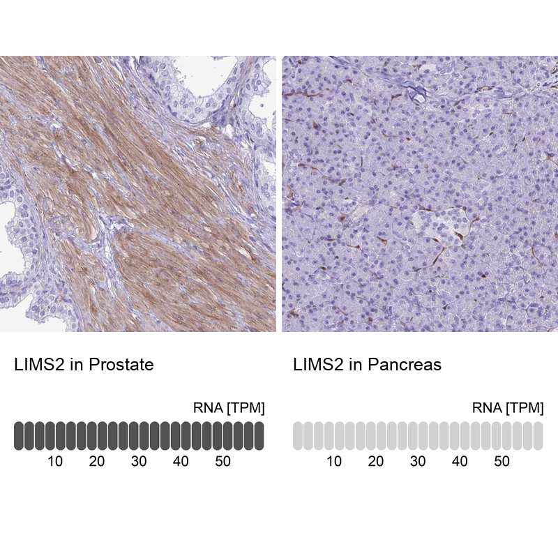 Anti-LIMS2 Antibody
