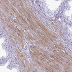 Immunohistochemical staining of human prostate shows moderate membranous positivity in smooth muscle cells.