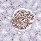 Immunohistochemical staining of human kidney shows strong membranous positivity in cells in glomeruli.