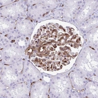 Immunohistochemical staining of human kidney shows strong membranous positivity in cells in glomeruli.