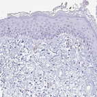 Immunohistochemical staining of human skin shows low positivity in squamous epithelial cells as expected.