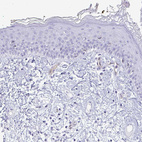 Anti-LIMS2 Antibody