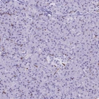 Immunohistochemical staining of human pancreas shows low positivity in exocrine glandular cells as expected.