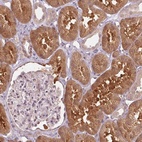 Anti-PPIA Antibody