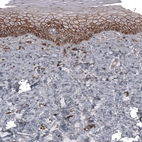 Immunohistochemical staining of human uterine cervix shows strong membranous positivity in squamous epithelial cells.