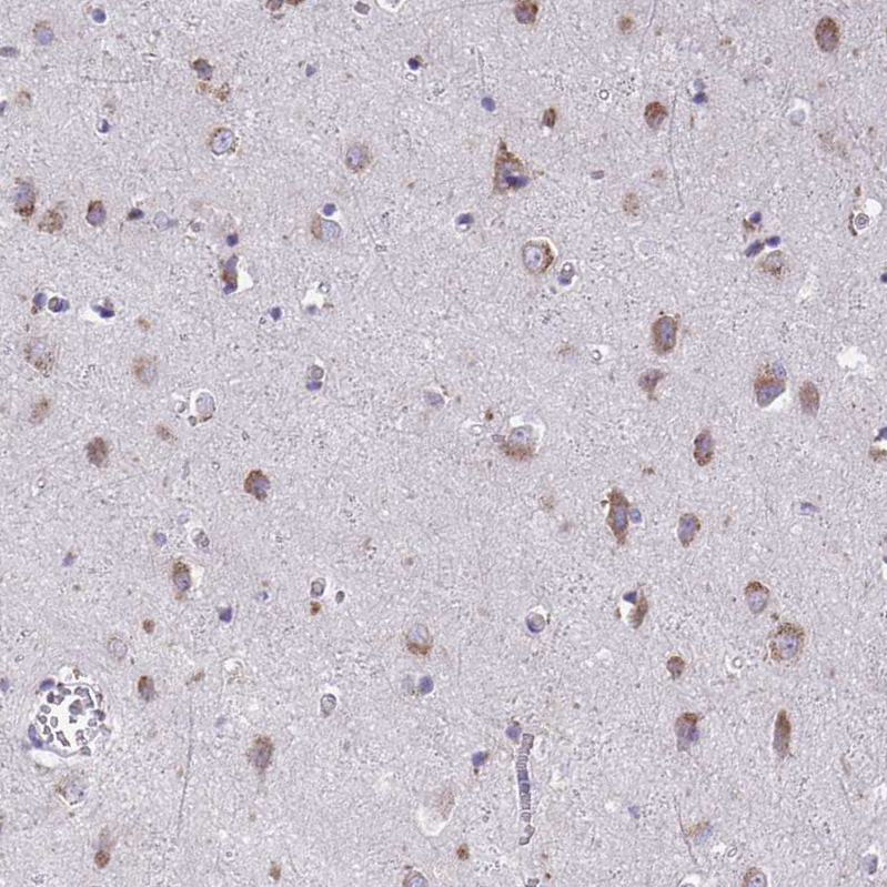 Anti-TMEM106B Antibody