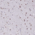 Anti-TMEM106B Antibody