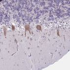Immunohistochemical staining of human cerebellum shows positivity in Purkinje cells.