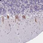 Anti-TMEM106B Antibody