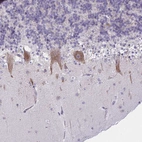 Immunohistochemical staining of human cerebellum shows positivity in Purkinje cells.