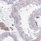 Immunohistochemical staining of human testis shows cytoplasmic positivity in cells in seminiferous ducts and in Leydig cells..
