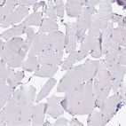 Immunohistochemical staining of human skeletal muscle shows no positivity in myocytes as expected.