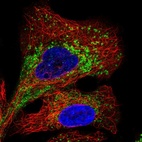 Anti-TMEM106B Antibody