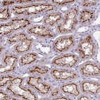Anti-TOR1AIP2 Antibody