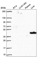 Anti-SLC14A1 Antibody