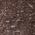 Immunohistochemical staining of human lymph node shows strong membranous positivity in lymphoid cells.