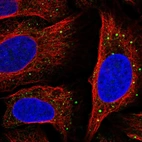 Immunofluorescent staining of human cell line U-2 OS shows localization to vesicles.