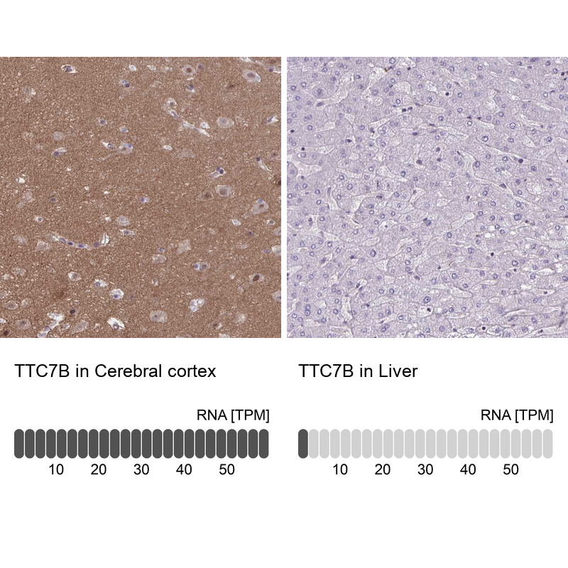 Anti-TTC7B Antibody