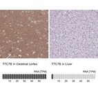 Anti-TTC7B Antibody