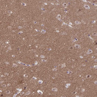 Immunohistochemical staining of human cerebral cortex shows strong positivity in neuropil.