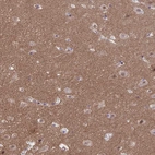 Immunohistochemical staining of human cerebral cortex shows strong positivity in neuropil.