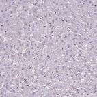 Immunohistochemical staining of human liver shows no positivity in hepatocytes as expected.