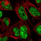 Anti-RNF169 Antibody