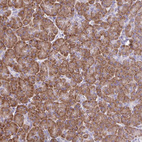 Anti-RPL7 Antibody