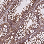 Immunohistochemical staining of human colon shows strong cytoplasmic positivity in glandular cells.