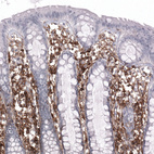 Anti-CD44 Antibody