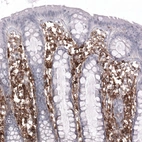 Immunohistochemical staining of human colon shows strong membranous positivity in lymphoid cells.