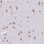 Immunohistochemical staining of human cerebral cortex shows moderate cytoplasmic positivity in neuronal cells.