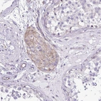 Immunohistochemical staining of human testis shows moderate cytoplasmic positivity in Leydig cells.