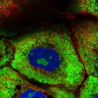 Immunofluorescent staining of human cell line A-431 shows localization to nucleoli, cytosol & endoplasmic reticulum.