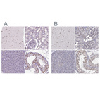 Anti-SETD1A Antibody