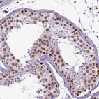 Immunohistochemical staining of human Testis shows strong nuclear positivity in cells in seminiferous ducts.