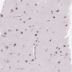 Anti-SETD1A Antibody