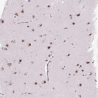 Immunohistochemical staining of human Cerebral cortex shows moderate nuclear positivity in neuronal and glial cells.