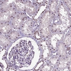 Immunohistochemical staining of human Kidney shows moderate nuclear positivity in cells in tubules and glomeruli.